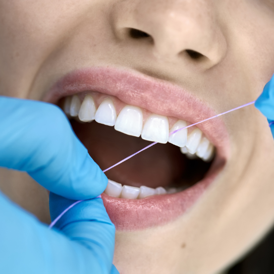Blog post (35) Dentist in Topeka
