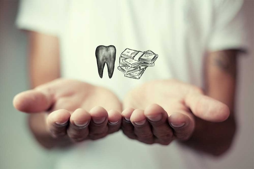 dental implants