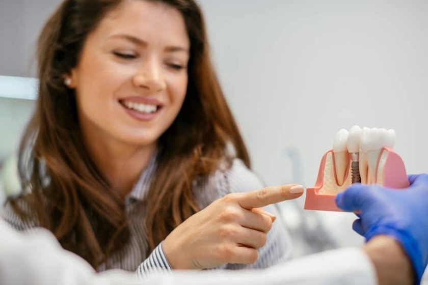 dental implants
